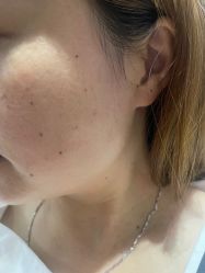点击看大图 -广州美莱医疗美容医院