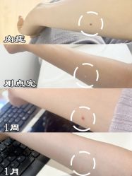 -清疣美疣·痣·斑净肤中心