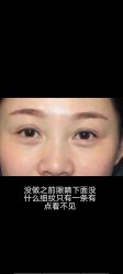 -泉州欧菲医疗美容