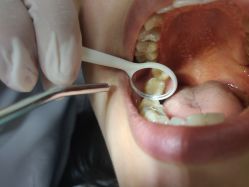 体验后-深圳春天阳光医院·轮廓抗衰中心