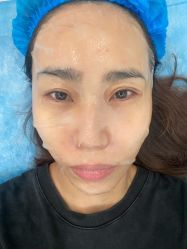 体验后-SKINIST丽铂医疗美容