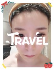 -大麦微针植发全国连锁
