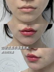 -深圳艺星医疗美容医院
