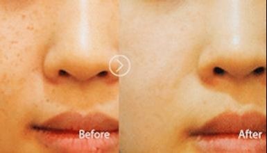 点击看大图 -SKINIST丽铂医疗美容