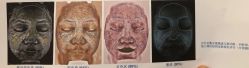 体验后-成都艾特他整形外科医院