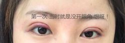 -成都西区医院整形美容