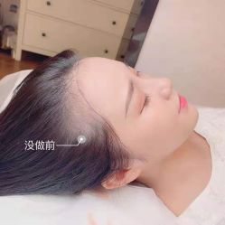 -OnFaer.纹眉半永久无创洗眉