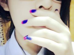 术后一个月-上海华安整形外科门诊部