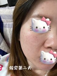 体验后-安徽合肥韩美整形外科医院
