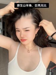 -碧莲盛·不剃发植发