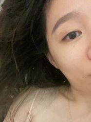 体验前-伊美尔医疗美容医院