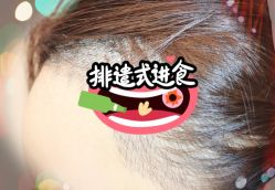 -大麦微针植发全国连锁