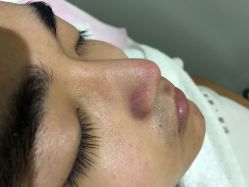-苑苑vbeauty科技美容SPA