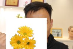 -大麦微针植发丨全国连锁