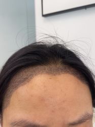 -熙朵美学植发·连锁品牌