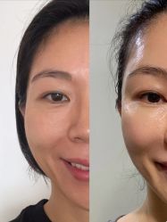 点击看大图 -AIST爱思特医疗美容医院