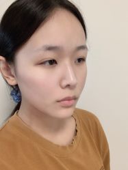 -杭州米兰柏羽医疗美容医院