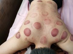 -沈师傅盲人按摩工作室(密三小区店)