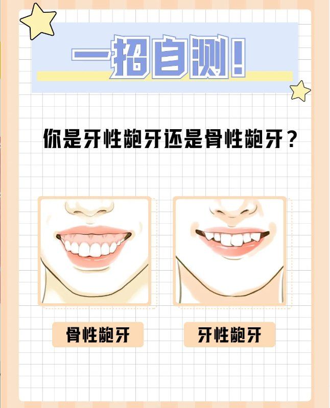 一招自测!92你是牙性龅牙还是骨性龅牙?