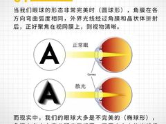 -菲越企鹅眼科(龙湖天街店)