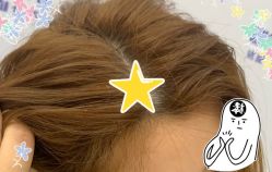 -大麦微针植发全国连锁