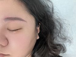 体验后-天津伊美尔医疗整形美容专科医院