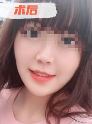 -素美医疗美容·西南眼鼻整形·修复基地