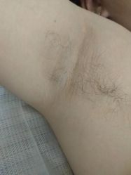 点击看大图 -日本直营PURE专业脱毛中心