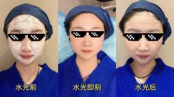 -针美汇欧邦医疗美容