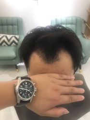 -发饰美男士增发补发假发定制店