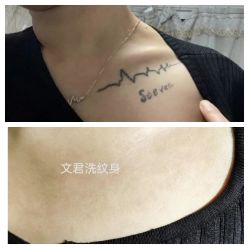 -净肤洗纹身