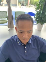 点击看大图 体验后-大麦微针植发全国连锁