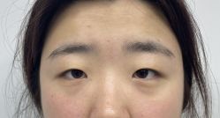 体验前-壹加壹医疗美容·轻医美·美容外科