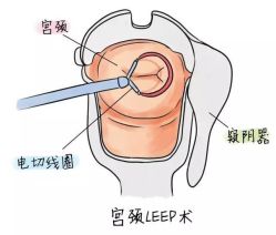 -邢台妇产医院