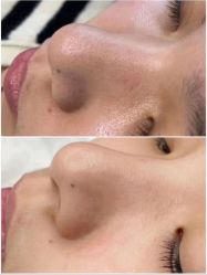 -美肤盾祛痘·问题肌头疗管理中心