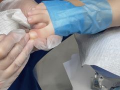 -Andrew指甲专科灰指甲·甲沟炎矫正·3D步态矫形鞋垫定制(浦三路店)