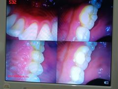 -土豆口腔(凤凰北总店)