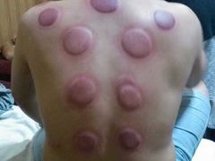 -张钰强中医正骨推拿连锁(唐家人才公寓店)