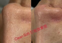 点击看大图 -skin79皮肤管理中心