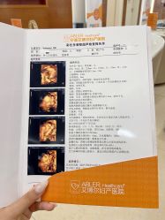 -艾博尔医院