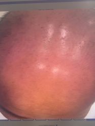 -雍禾植发全国连锁