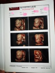 -杭州贝瑞斯美华妇儿医院·早孕·产检·儿科