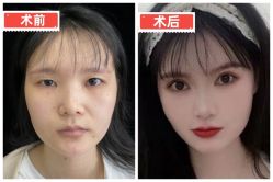 -素美医疗美容·西南眼鼻整形·修复基地