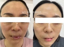 -美愈美肤MEIYU SKIN