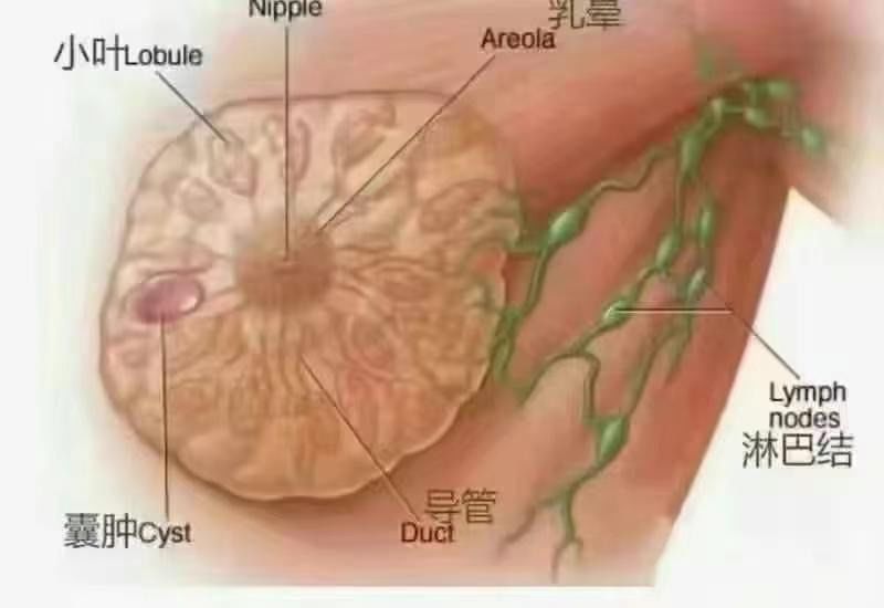乳腺增生分五个期
第一期:小叶增生