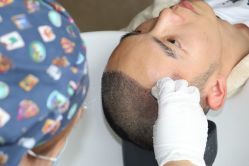 点击看大图 -大麦微针植发丨全国连锁