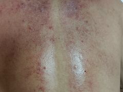 -紫瑞中医馆·养生推拿·中式筋膜(龙华店)