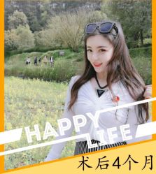 -大麦微针植发全国连锁