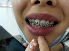 -宁波壹加壹口腔·矫正种植中心