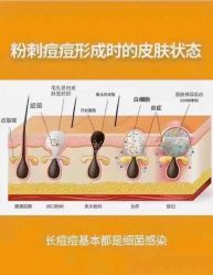 -+MS卓美丝专业祛痘·皮肤管理中心